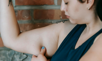 Kritischer Griff zu Trizeps